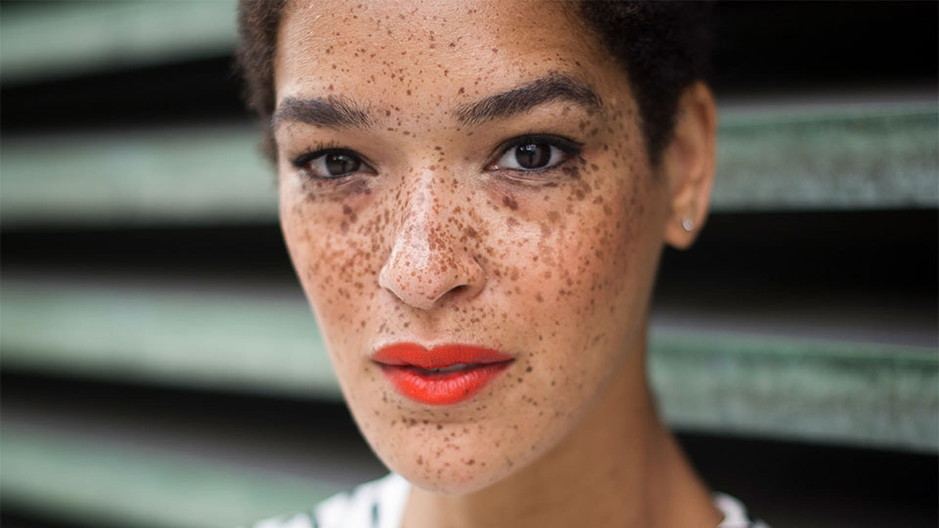 去除脸上的黑斑原因，最好的面霜，家庭补救和面部黑斑的治疗美国腹腔18bet金宝搏 188beat,188金宝搏博彩,18bet金宝搏